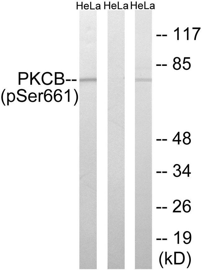 PRKCB / PKC-Beta Antibody - Lane 1: The extracts from HeLa cells treated with heat shock using PKCB (Phospho-Ser661) antibody Lane 2: The extracts from HeLa cells treated with heat shock plus phosphopeptide using PKCB (Phospho-Ser661) antibody Lane 3: The extracts from HeLa cells treated with heat shock using PKCB (Ab-661) antibody