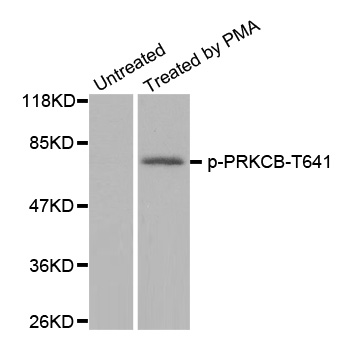 PRKCB / PKC-Beta Antibody - Western blot analysis of extracts from JK cells.