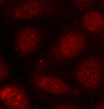 PRKCB / PKC-Beta Antibody - Immunofluorescence staining of methanol-fixed MCF7 cells.