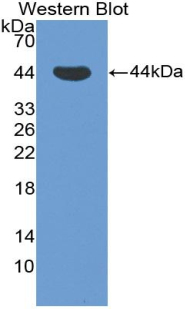 PRKCD / PKC-Delta Antibody - Western blot of recombinant PRKCD / PKC-Delta.