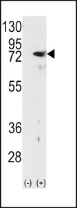 PRKCD / PKC-Delta Antibody - Western blot of PKC delta (arrow) using rabbit polyclonal PKC delta Antibody. 293 cell lysates (2 ug/lane) either nontransfected (Lane 1) or transiently transfected with the PRKCD gene (Lane 2) (Origene Technologies).