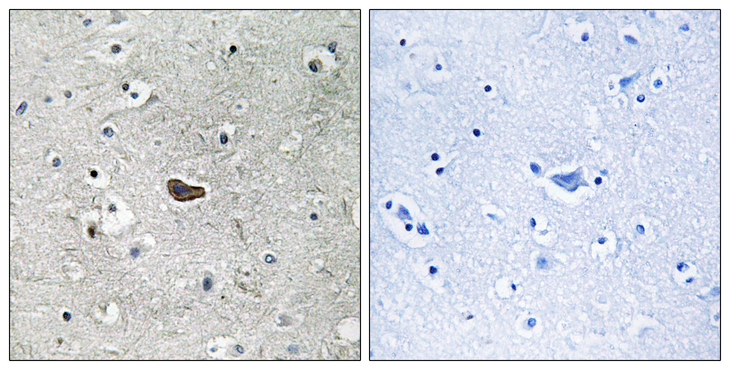 PRKCD / PKC-Delta Antibody - Immunohistochemistry analysis of paraffin-embedded human brain tissue, using PKC delta Antibody. The picture on the right is blocked with the synthesized peptide.