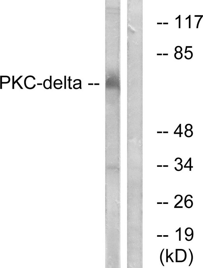 PRKCD / PKC-Delta Antibody - Western blot analysis of lysates from MCF7 cells, using PKC delta Antibody. The lane on the right is blocked with the synthesized peptide.