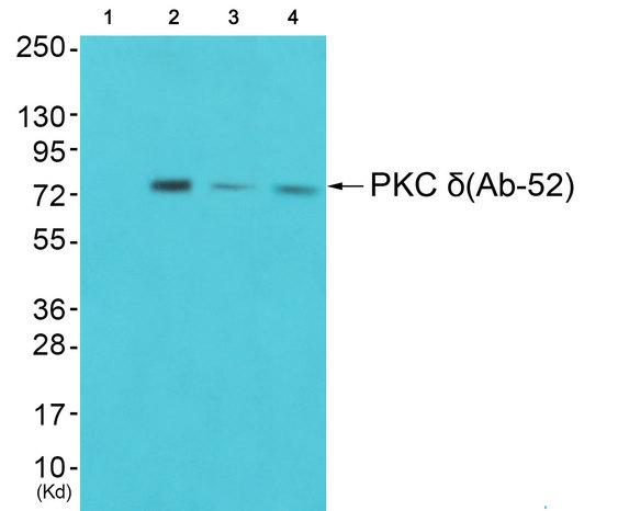 PRKCD / PKC-Delta Antibody - Western blot analysis of extracts from NIH/3T3 cells, COLO cells and K562 cells, using PKC d antibody.