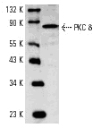 PRKCD / PKC-Delta Antibody - Western blot of PKC (G499) pAb in extracts from MCF7 cells.
