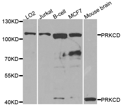 PRKCD / PKC-Delta Antibody - Western blot analysis of extracts of various cell lines.