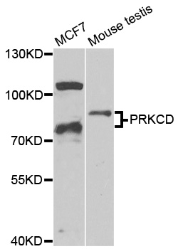 PRKCD / PKC-Delta Antibody - Western blot analysis of extracts of various cell lines, using PRKCD antibody at 1:1000 dilution. The secondary antibody used was an HRP Goat Anti-Rabbit IgG (H+L) at 1:10000 dilution. Lysates were loaded 25ug per lane and 3% nonfat dry milk in TBST was used for blocking. An ECL Kit was used for detection and the exposure time was 90s.