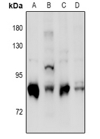 PRKCD / PKC-Delta Antibody - Western blot analysis of PKC delta (pS664) expression in Hela (A), A549 (B), mouse uterus (C), rat uterus (D) whole cell lysates.