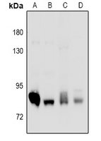 PRKCD / PKC-Delta Antibody - Western blot analysis of PKC delta expression in Hela (A), HCT116 (B), mouse lung (C), rat lung (D) whole cell lysates.