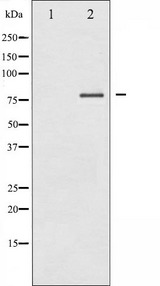 PRKCD / PKC-Delta Antibody - Western blot analysis of PKC delta expression in MCF-7 whole cells lysates. The lane on the left is treated with the antigen-specific peptide.