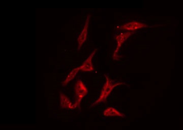 PRKCD / PKC-Delta Antibody - Staining NIH-3T3 cells by IF/ICC. The samples were fixed with PFA and permeabilized in 0.1% Triton X-100, then blocked in 10% serum for 45 min at 25°C. The primary antibody was diluted at 1:200 and incubated with the sample for 1 hour at 37°C. An Alexa Fluor 594 conjugated goat anti-rabbit IgG (H+L) Ab, diluted at 1/600, was used as the secondary antibody.