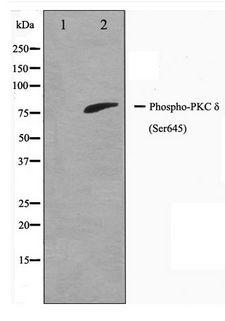 PRKCD / PKC-Delta Antibody - Western blot of PKC delta phosphorylation expression in MCF7 whole cell lysates,The lane on the left is treated with the antigen-specific peptide.