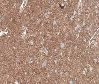 PRKCD / PKC-Delta Antibody - 1:200 staining human brain tissue by IHC-P. The tissue was formaldehyde fixed and a heat mediated antigen retrieval step in citrate buffer was performed. The tissue was then blocked and incubated with the antibody for 1.5 hours at 22°C. An HRP conjugated goat anti-rabbit antibody was used as the secondary.
