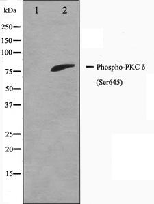 PRKCD / PKC-Delta Antibody - Western blot analysis of PKC delta phosphorylation expression in MCF-7 whole cells lysates. The lane on the left is treated with the antigen-specific peptide.