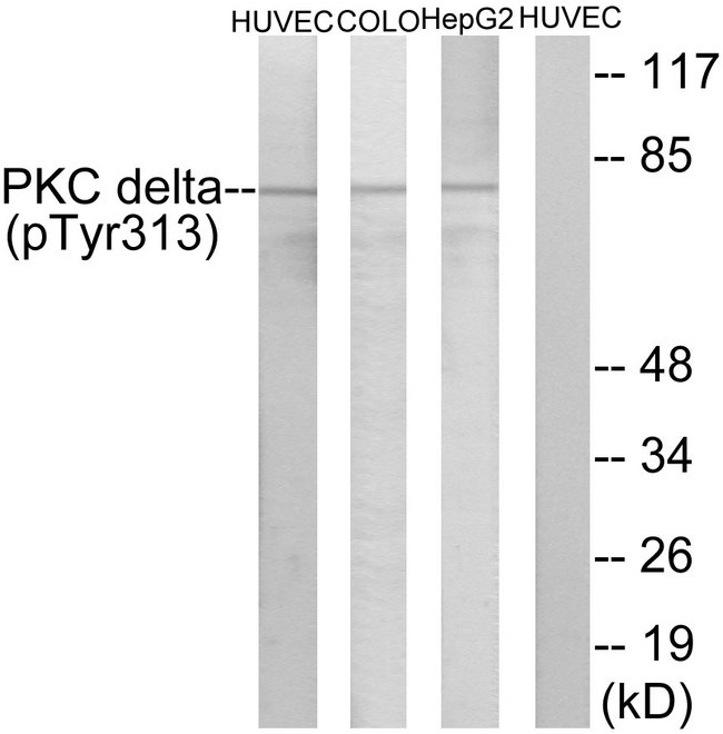 PRKCD / PKC-Delta Antibody - Western blot analysis of lysates from HepG2 cells, COLO205 cells and HUVEC cells, using PKC delta (Phospho-Tyr313) Antibody. The lane on the right is blocked with the phospho peptide.