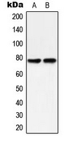 PRKCD / PKC-Delta Antibody - Western blot analysis of PKC delta (pY313) expression in HeLa (A); MCF7 Calyculin A-treated (B) whole cell lysates.