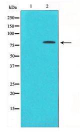 PRKCD / PKC-Delta Antibody - Western blot of PKC delta phosphorylation expression in HepG2 whole cell lysates,The lane on the left is treated with the antigen-specific peptide.
