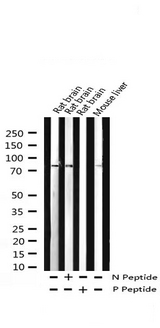 PRKCD / PKC-Delta Antibody - Western blot analysis of Phospho-PKC delta (Tyr313) expression in various lysates