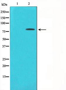 PRKCD / PKC-Delta Antibody - Western blot analysis of PKC delta phosphorylation expression in HepG2 whole cells lysates. The lane on the left is treated with the antigen-specific peptide.