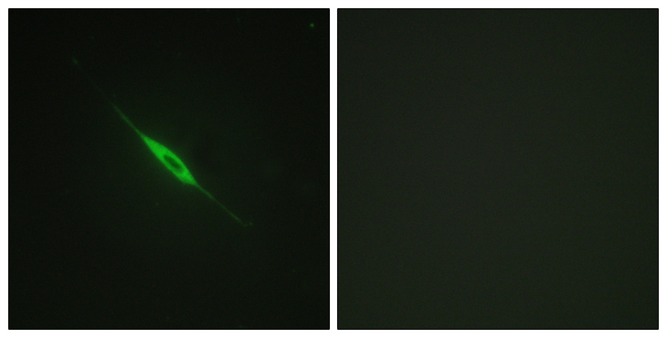 PRKCD / PKC-Delta Antibody - Immunofluorescence analysis of NIH/3T3 cells, using PKC delta (Phospho-Tyr52) Antibody. The picture on the right is blocked with the phospho peptide.