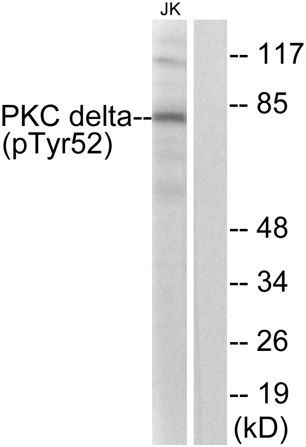 PRKCD / PKC-Delta Antibody - Western blot analysis of lysates from Jurkat cells treated with starved 24h, using PKC delta (Phospho-Tyr52) Antibody. The lane on the right is blocked with the phospho peptide.