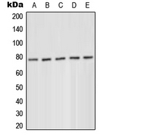 PRKCD / PKC-Delta Antibody - Western blot analysis of PKC delta (pY52) expression in MCF7 serum starvation-treated (A); HeLa PMA-treated (B); Jurkat (C); Raw264.7 serum starvation-treated (D); H9C2 serum starvation-treated (E) whole cell lysates.