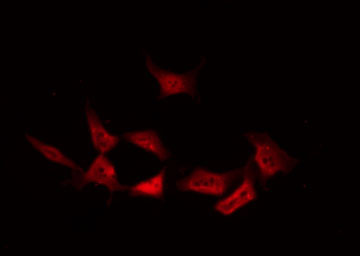 PRKCD / PKC-Delta Antibody - Staining NIH-3T3 cells by IF/ICC. The samples were fixed with PFA and permeabilized in 0.1% Triton X-100, then blocked in 10% serum for 45 min at 25°C. The primary antibody was diluted at 1:200 and incubated with the sample for 1 hour at 37°C. An Alexa Fluor 594 conjugated goat anti-rabbit IgG (H+L) Ab, diluted at 1/600, was used as the secondary antibody.