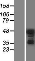 PRKCD / PKC-Delta Protein - Western validation with an anti-DDK antibody * L: Control HEK293 lysate R: Over-expression lysate