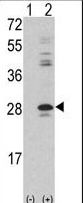 PRKCDBP / CAVIN3 Antibody - Western blot of PRKCDBP (arrow) using rabbit polyclonal PRKCDBP Antibody. 293 cell lysates (2 ug/lane) either nontransfected (Lane 1) or transiently transfected with the PRKCDBP gene (Lane 2) (Origene Technologies).