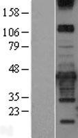 PRKCDBP / CAVIN3 Protein - Western validation with an anti-DDK antibody * L: Control HEK293 lysate R: Over-expression lysate