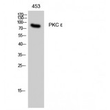 PRKCE / PKC-Epsilon Antibody - Western blot of PKC epsilon antibody