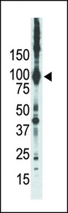 PRKCE / PKC-Epsilon Antibody - Western blot of anti-PKC epsilon antibody in placenta lysate. PKC epsilon (Arrow) was detected using purified antibody. Secondary HRP-anti-rabbit was used for signal visualization with chemiluminescence.