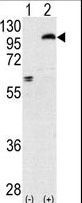 PRKCE / PKC-Epsilon Antibody - Western blot of PRKCE (arrow) using rabbit polyclonal PKC epsilon Antibody. 293 cell lysates (2 ug/lane) either nontransfected (Lane 1) or transiently transfected with the PRKCE gene (Lane 2) (Origene Technologies).