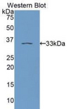 PRKCE / PKC-Epsilon Antibody - Western blot of recombinant PRKCE / PKC-Epsilon.  This image was taken for the unconjugated form of this product. Other forms have not been tested.