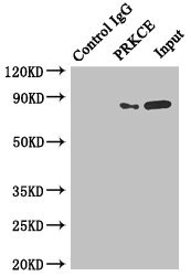 PRKCE / PKC-Epsilon Antibody - Immunoprecipitating PRKCE in MCF-7 whole cell lysate Lane 1: Rabbit monoclonal IgG (1µg) instead of PRKCE Antibody in MCF-7 whole cell lysate. For western blotting, a HRP-conjugated anti-rabbit IgG, specific to the non-reduced form of IgG was used as the Secondary antibody (1/50000) Lane 2: PRKCE Antibody (4µg) + MCF-7 whole cell lysate (500µg) Lane 3: MCF-7 whole cell lysate (20µg)