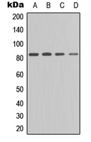 PRKCE / PKC-Epsilon Antibody - Western blot analysis of PKC epsilon (pS729) expression in HT29 (A); A549 (B); HeLa (C); NIH3T3 (D) whole cell lysates.
