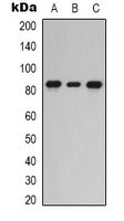 PRKCE / PKC-Epsilon Antibody - Western blot analysis of PKC epsilon expression in HEK293T (A); HeLa (B); HepG2 (C) whole cell lysates.