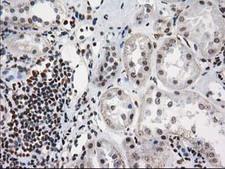 PRKCE / PKC-Epsilon Antibody - IHC of paraffin-embedded Human Kidney tissue using anti-PRKCE mouse monoclonal antibody.