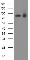 PRKCE / PKC-Epsilon Antibody - HEK293T cells were transfected with the pCMV6-ENTRY control (Left lane) or pCMV6-ENTRY PRKCE (Right lane) cDNA for 48 hrs and lysed. Equivalent amounts of cell lysates (5 ug per lane) were separated by SDS-PAGE and immunoblotted with anti-PRKCE.