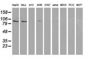 PRKCE / PKC-Epsilon Antibody - Western blot of extracts (35 ug) from 9 different cell lines by using anti-PRKCE monoclonal antibody.