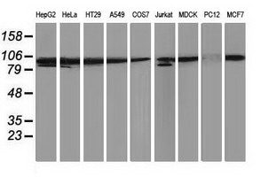 PRKCE / PKC-Epsilon Antibody - Western blot of extracts (35 ug) from 9 different cell lines by using g anti-PRKCE monoclonal antibody (HepG2: human; HeLa: human; SVT2: mouse; A549: human; COS7: monkey; Jurkat: human; MDCK: canine; PC12: rat; MCF7: human).