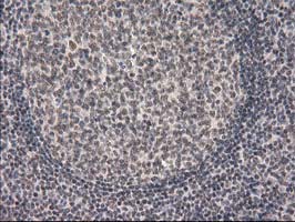 PRKCE / PKC-Epsilon Antibody - IHC of paraffin-embedded Human lymph node tissue using anti-PRKCE mouse monoclonal antibody. (Heat-induced epitope retrieval by 10mM citric buffer, pH6.0, 100C for 10min).
