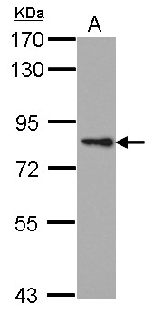PRKCE / PKC-Epsilon Antibody - Sample (30 ug of whole cell lysate) A: A431 7.5% SDS PAGE PRKCE / PKC-Epsilon antibody diluted at 1:1000