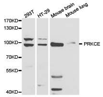 PRKCE / PKC-Epsilon Antibody - Western blot of extracts of various cell lines, using PRKCE antibody.
