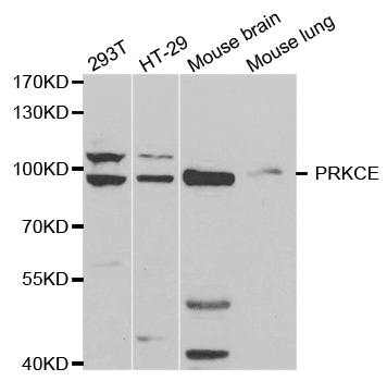 PRKCE / PKC-Epsilon Antibody - Western blot analysis of extracts of various cell lines, using PRKCE antibody.