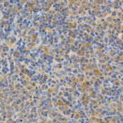 PRKCE / PKC-Epsilon Antibody - Immunohistochemistry of paraffin-embedded rat spleen using PRKCE antibody at dilution of 1:200 (x400 lens).