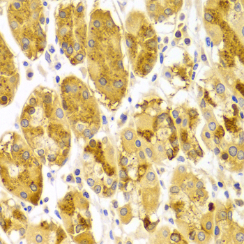 PRKCE / PKC-Epsilon Antibody - Immunohistochemistry of paraffin-embedded Human gastric tissue.