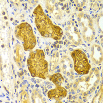 PRKCE / PKC-Epsilon Antibody - Immunohistochemistry of paraffin-embedded Human kidney tissue.