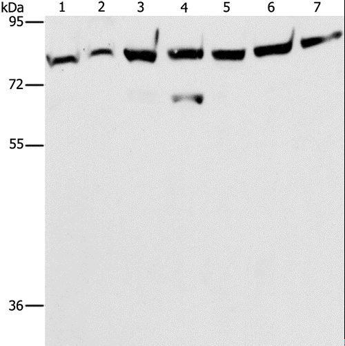 PRKCE / PKC-Epsilon Antibody - Western blot analysis of A172 cell and mouse brain tissue, K562, 231, A549, HeLa and hepG2 cell, using PRKCE Polyclonal Antibody at dilution of 1:400.