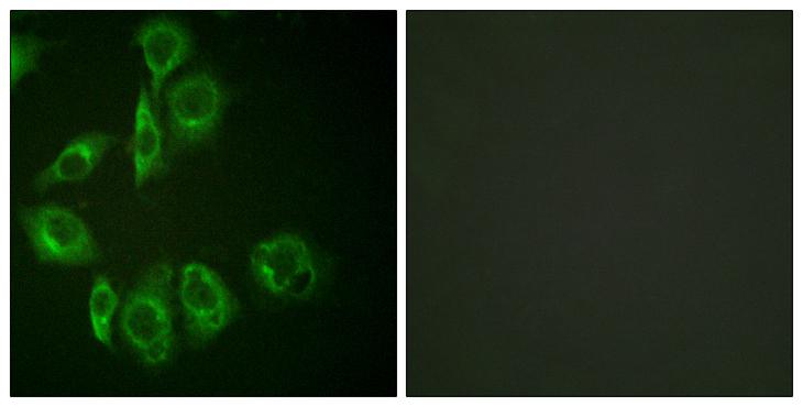 PRKCE / PKC-Epsilon Antibody - Peptide - + Immunofluorescence analysis of HuvEc cells, using PKC-pan (Ab-497) antibody.